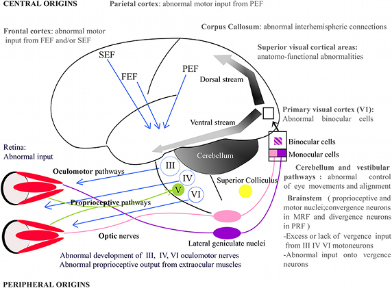 Diagram from Origins of Strabismus